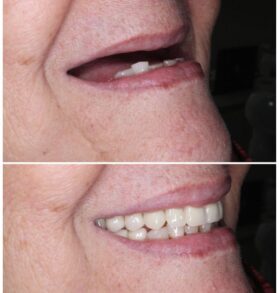 {{brizy_dc_image_alt imageSrc=