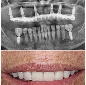 {{brizy_dc_image_alt imageSrc=